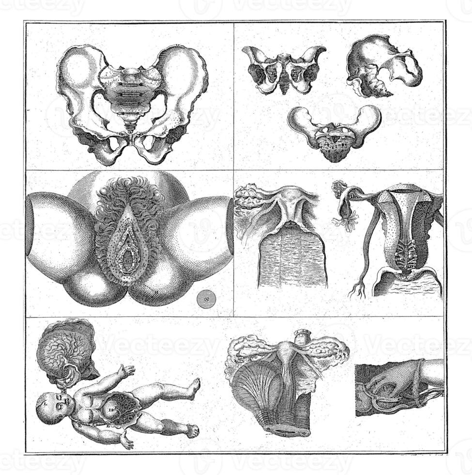 Gynaecological representations, Nicolaas van Frankendaal, after C. Plevier, 1730 - 1791 photo