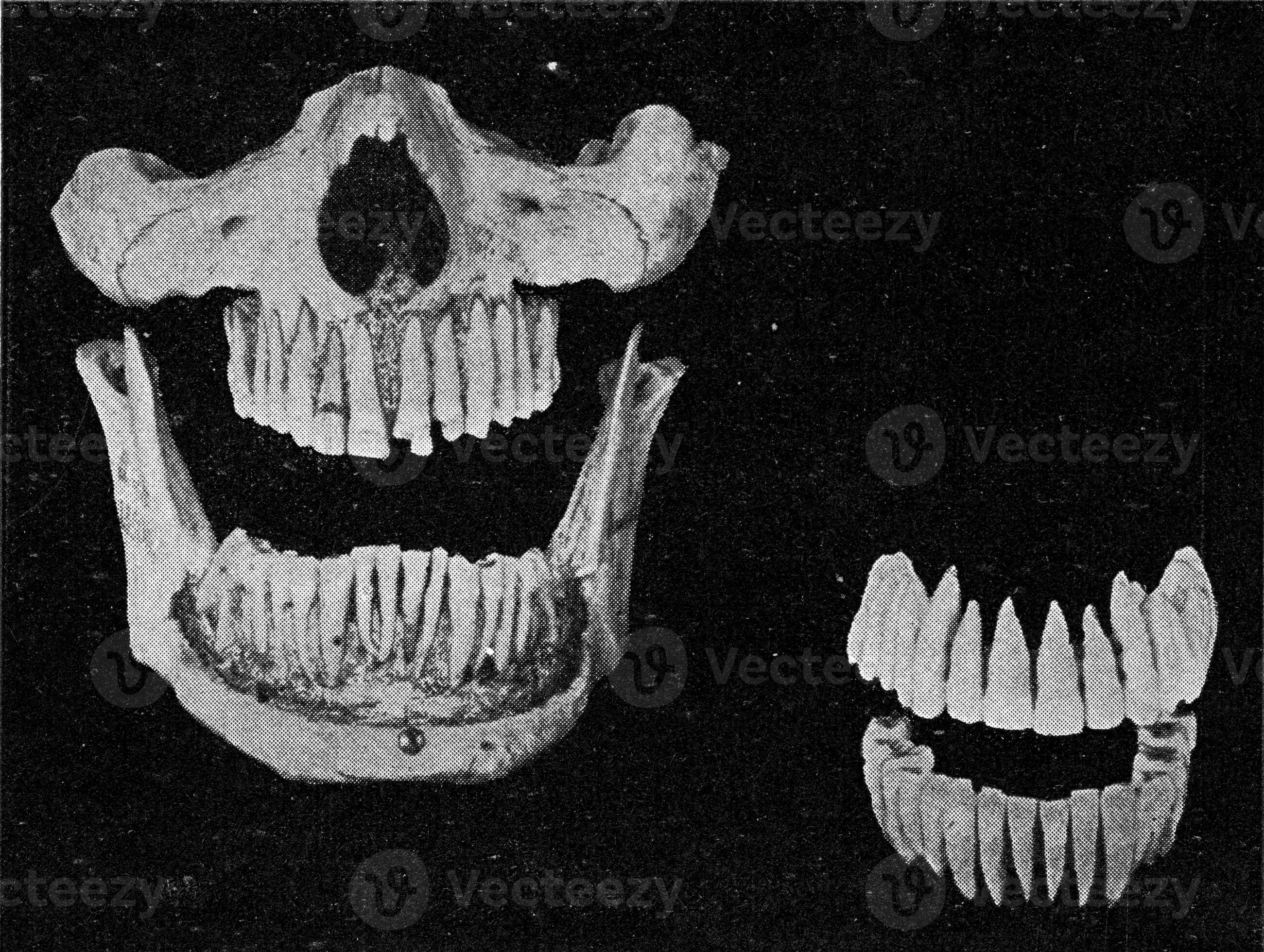 Human teeth on the jaw and the two rows of isolated teeth, vintage