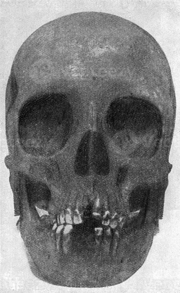 Skull of an Australian woman with eye orbits similar to those of the orang, vintage engraving. photo