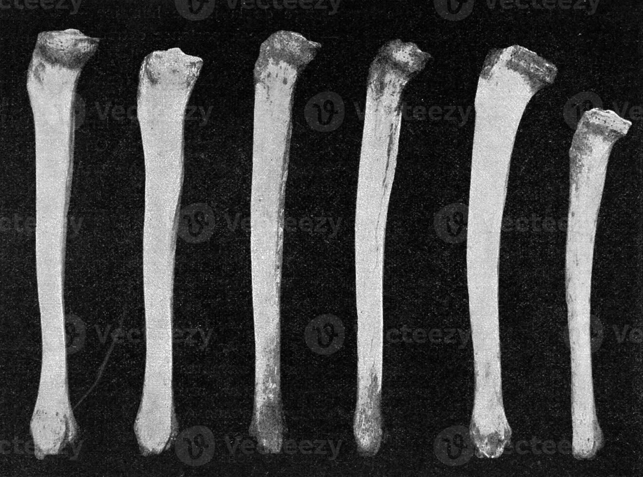Comparative table of tibias of different races seen internally, vintage engraving. photo