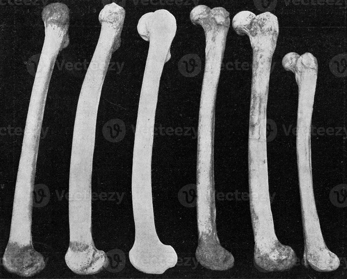 comparativo mesa de fémures de un europeo, un australiano, neanderthal hombre, un australiano, un africano negro y un enano negro de el filipinas, vinta foto