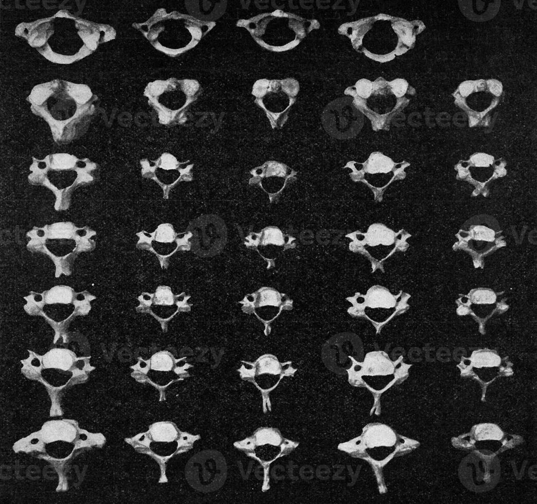 Comparative table of vertebral vertebrae of a European, two Australians, an African negro and a dwarf negro of the Philippines, vintage engraving. photo