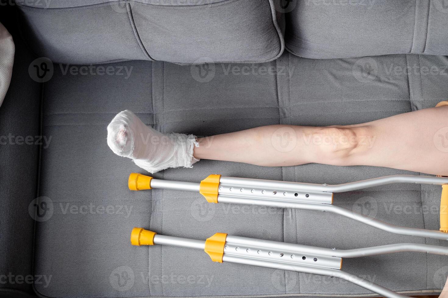 Woman with beautiful, long legs and a cast on her right leg with crutches lies on the sofa, top view photo