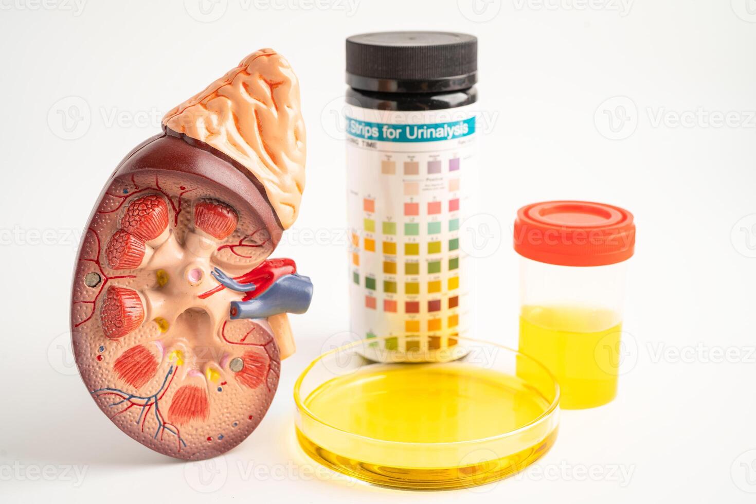Urinalysis, Kidney model and urine cup with reagent strip pH paper test and comparison chart in laboratory. photo