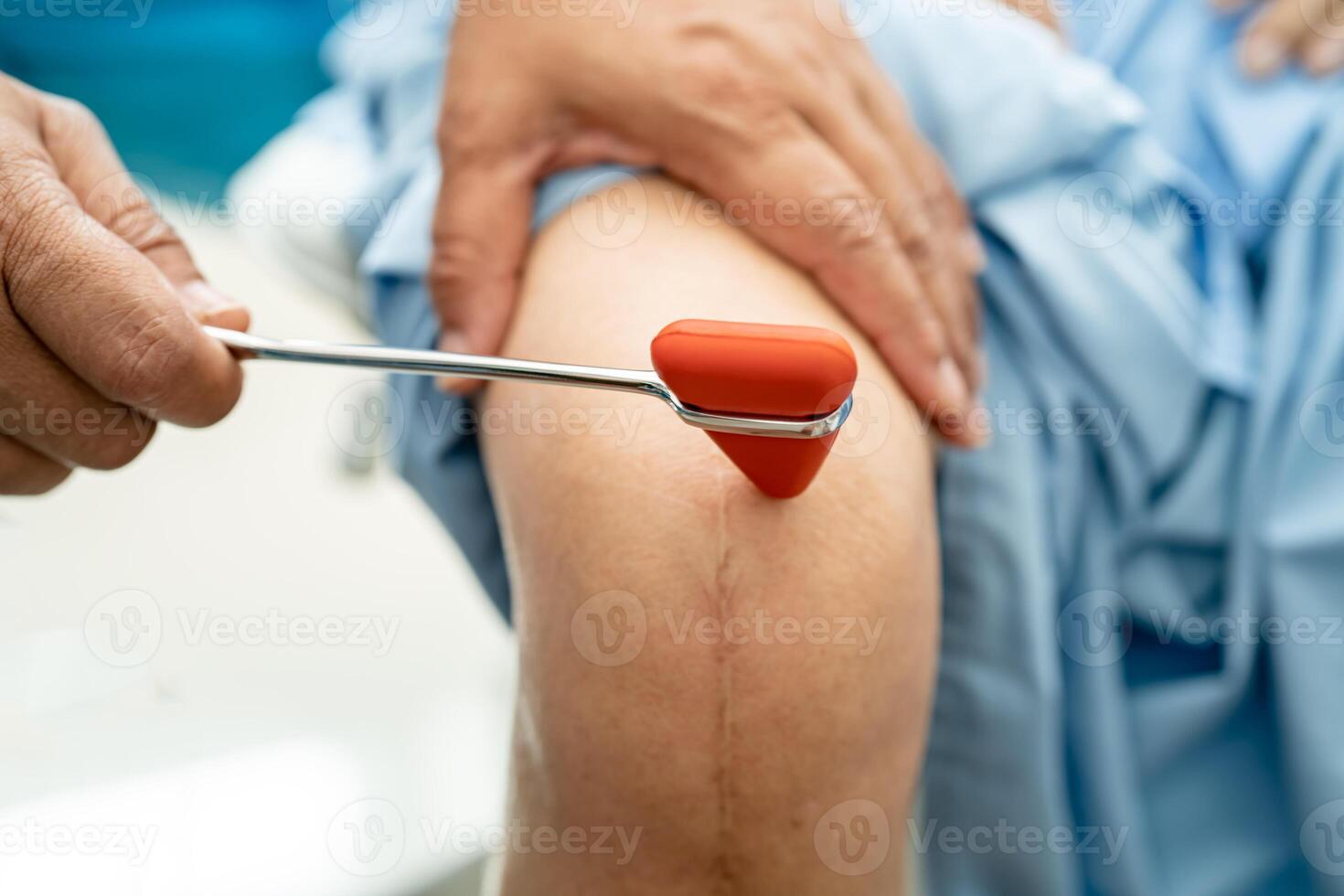 asiático médico utilizar martillo golpe mayor mujer paciente a cheque rodilla reflejo, nervio y músculo en hospital. foto