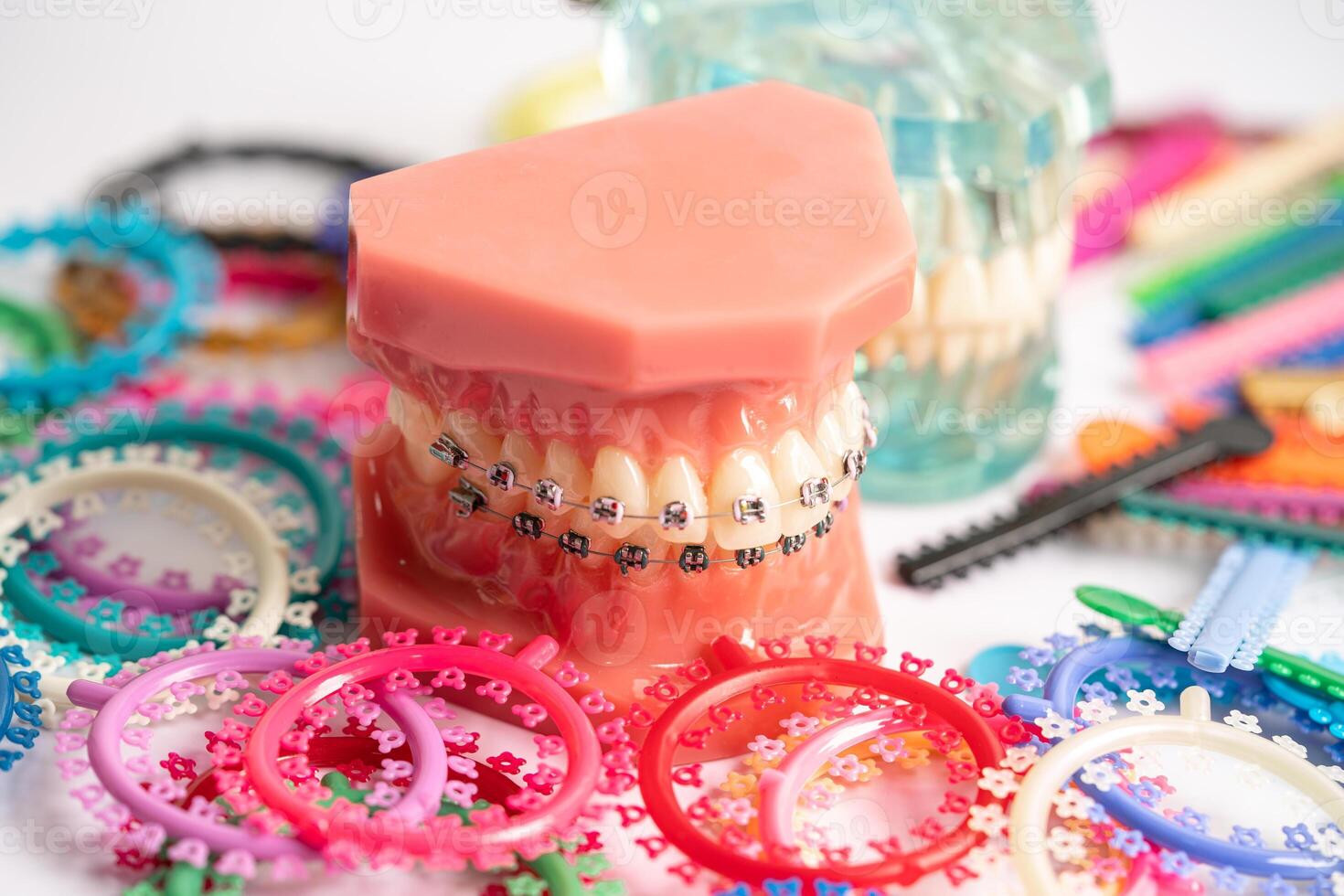 Orthodontic ligatures rings and ties, elastic rubber bands on orthodontic braces, model for dentist studying about dentistry. photo