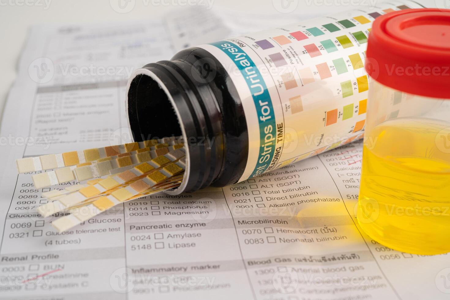 Urinalysis, urine cup with reagent strip pH paper test and comparison chart in laboratory. photo