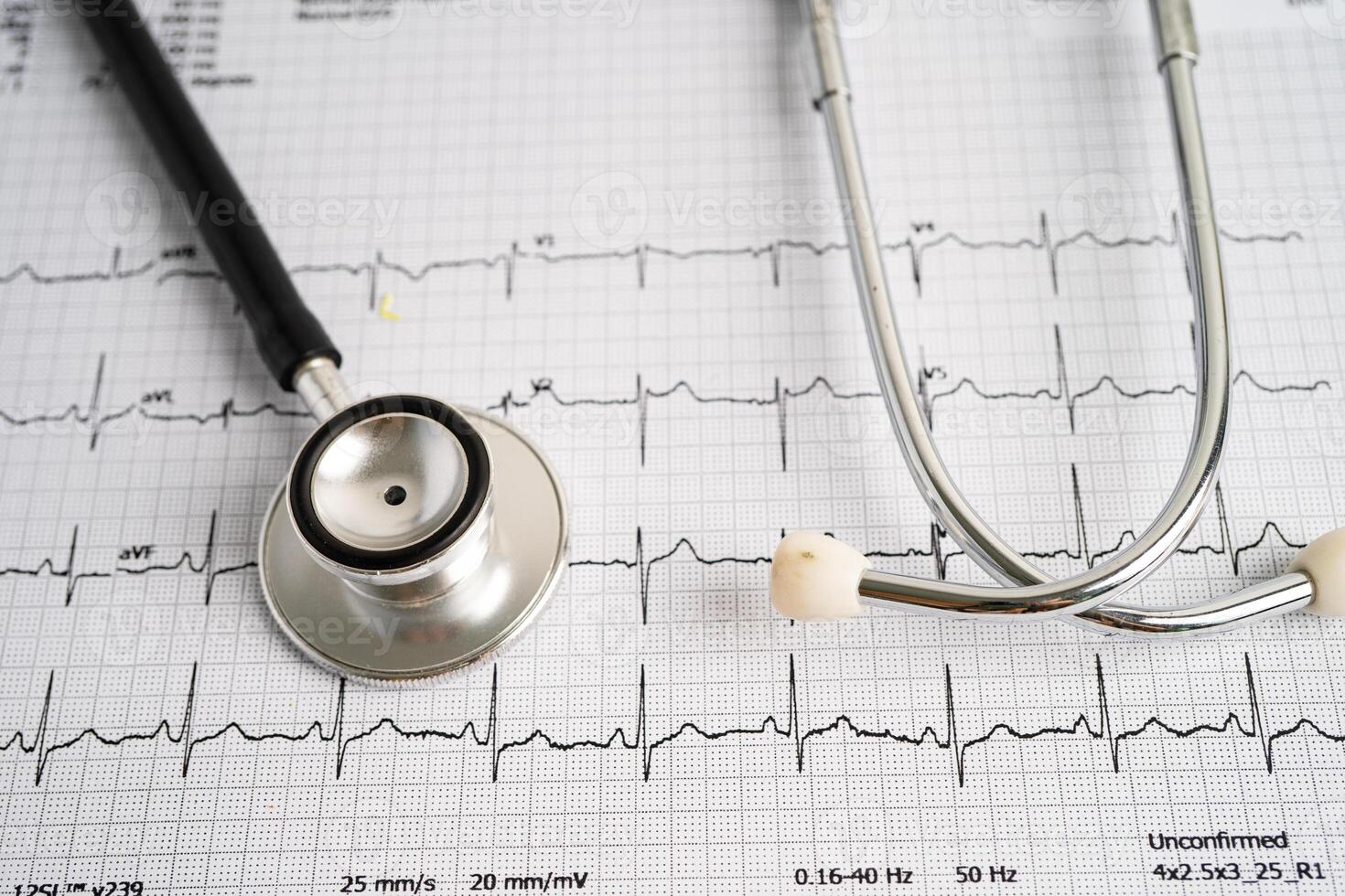 Stethoscope on electrocardiogram ECG, heart wave, heart attack, cardiogram report. photo