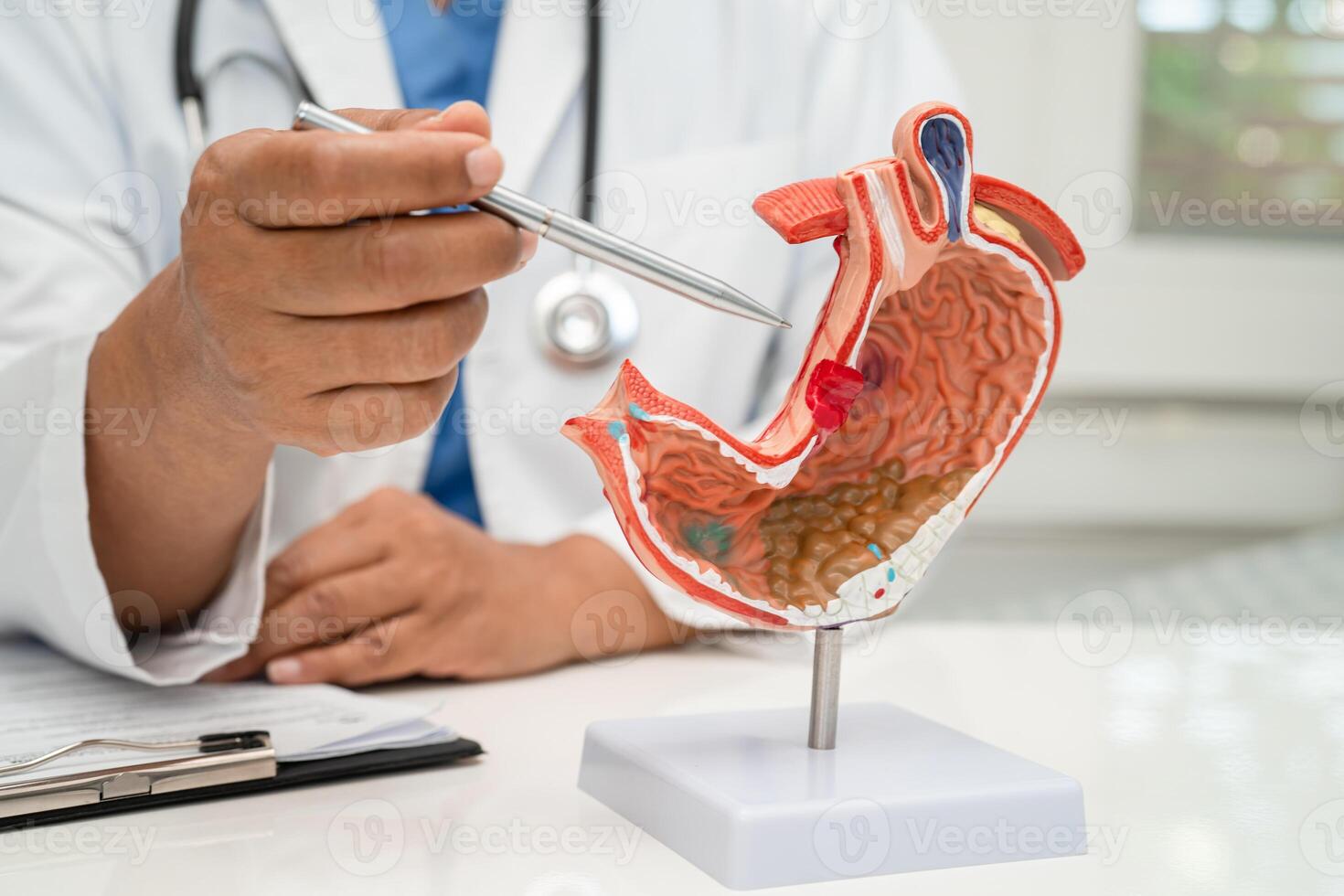 Stomach disease, doctor with anatomy model for study diagnosis and treatment in hospital. photo