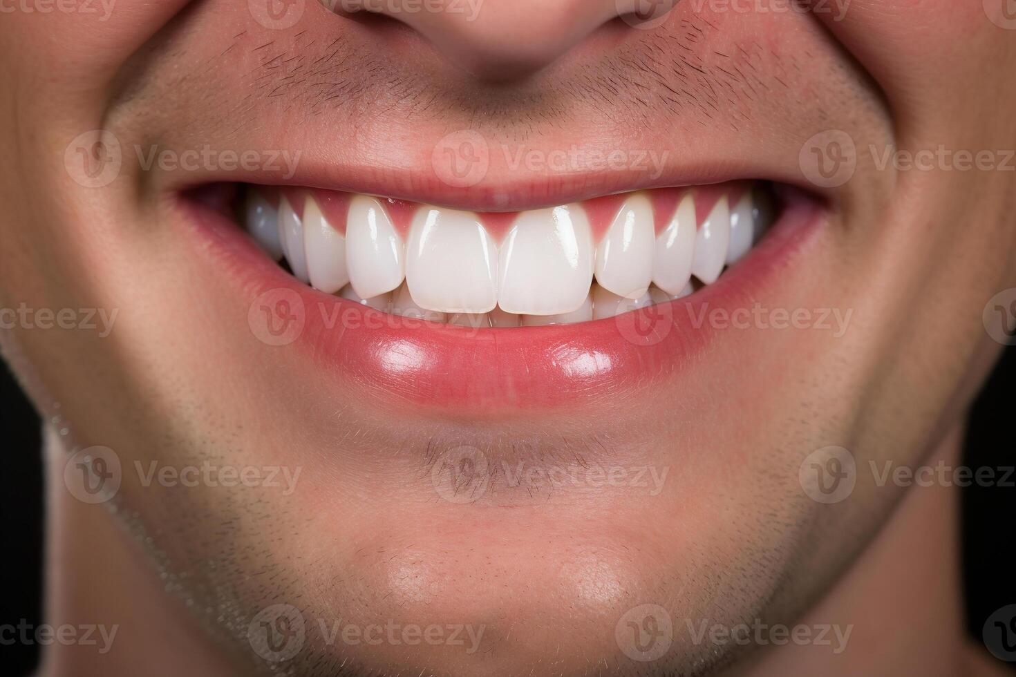 AI generated Front view of unrecognizable caucasian man smile, close-up of white teeth and fresh breath. Oral hygiene and dentist services concept photo