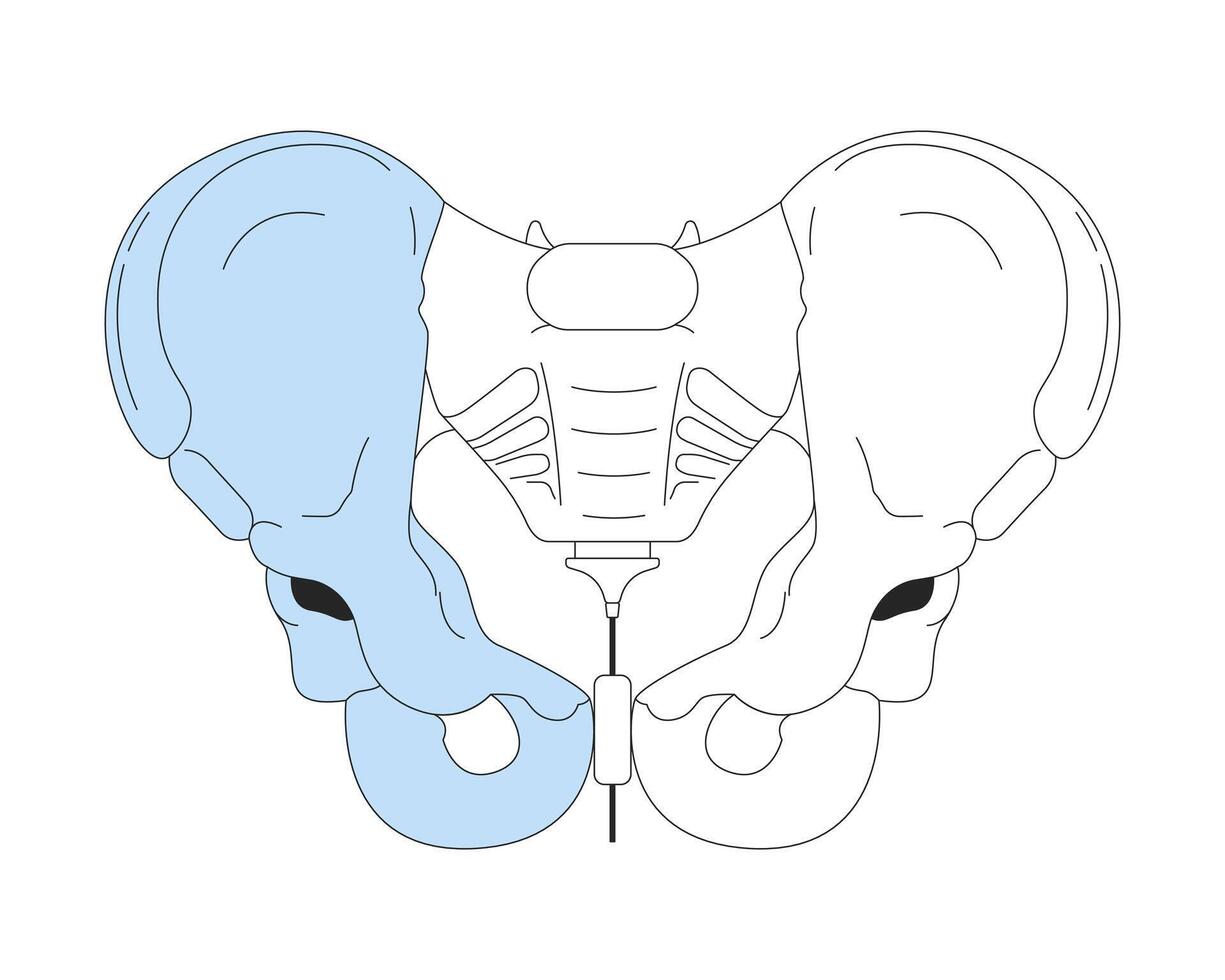 Pelvis bone anatomy 2D linear cartoon object. Pelvic girdle isolated line vector element white background. Medical surgery anatomical. Structure skeleton human body part color flat spot illustration