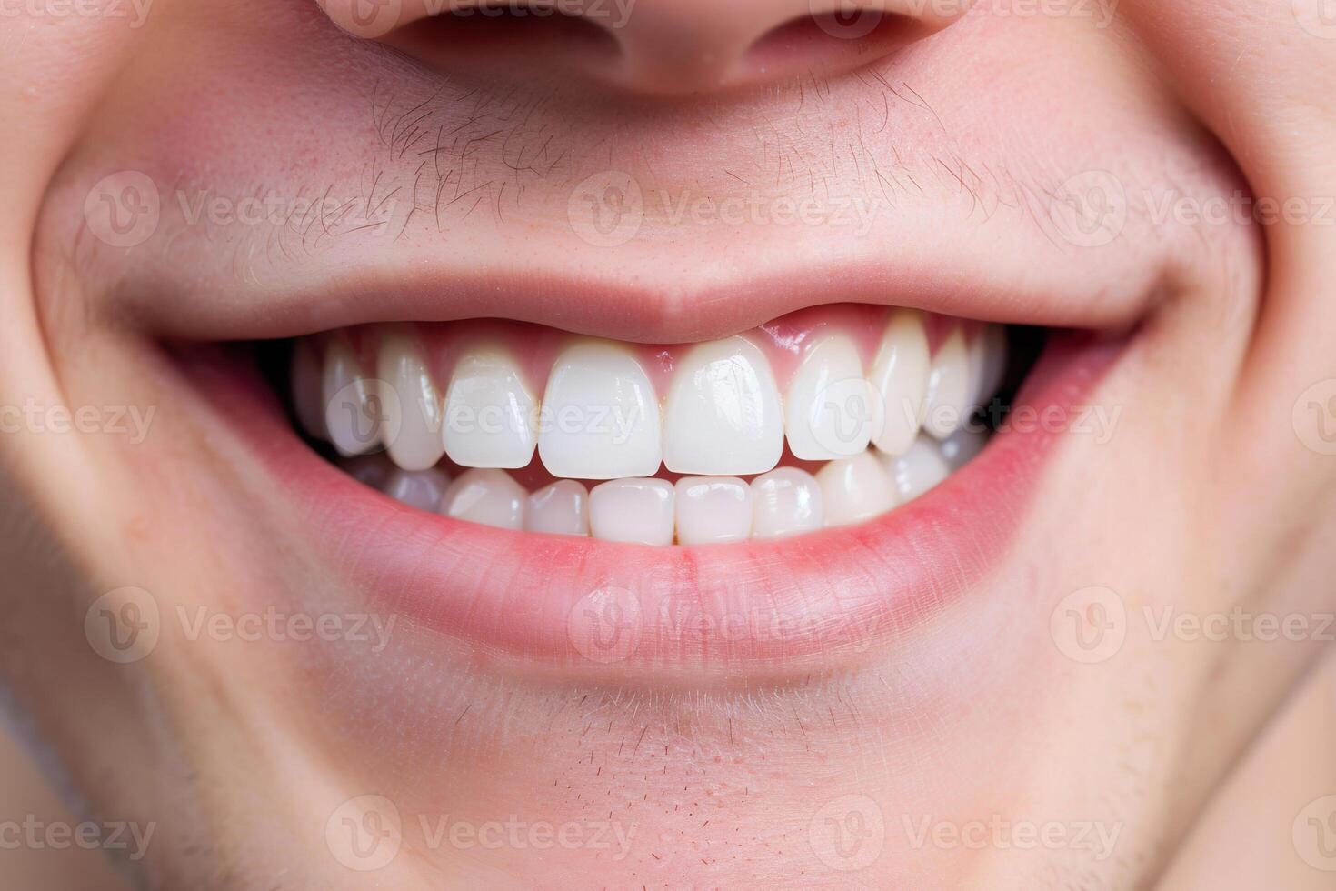 AI Generated Smiling young man mouth with healthy teeth, closeup photo