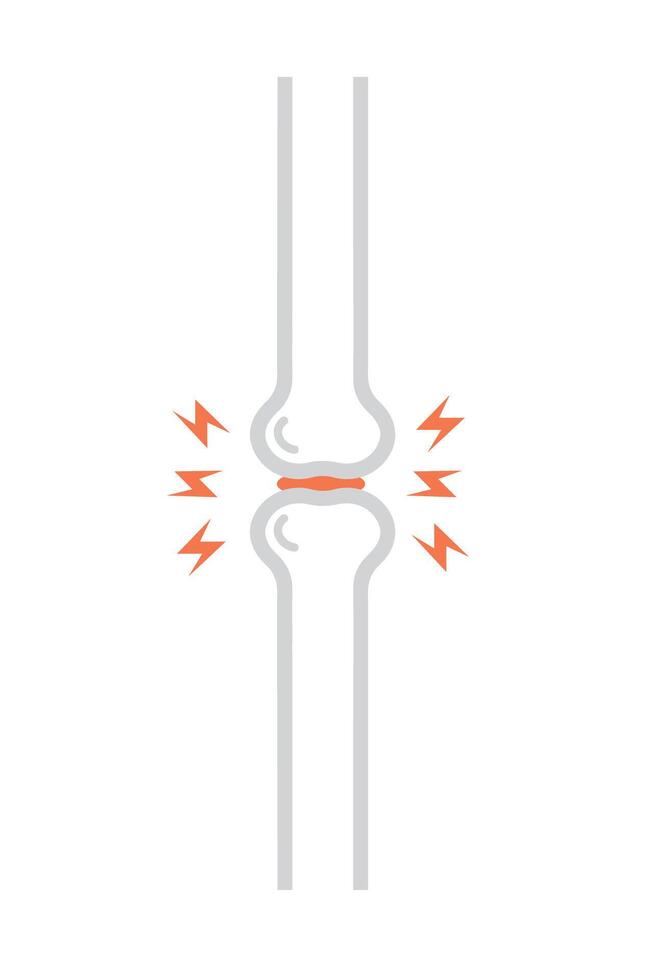 Arthritis knee joint pain. Pixel perfect, editable stroke icon vector