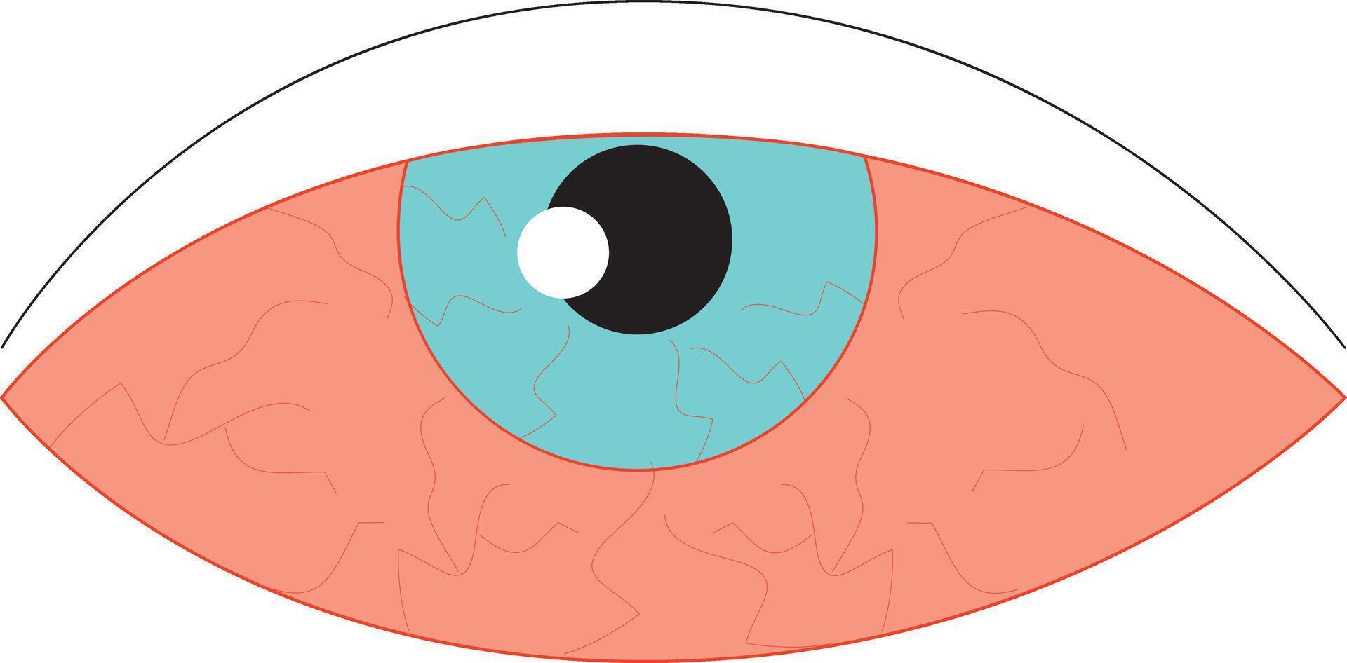 Eye sore line icon, disease and allergy, eye redness vector icon, vector graphics