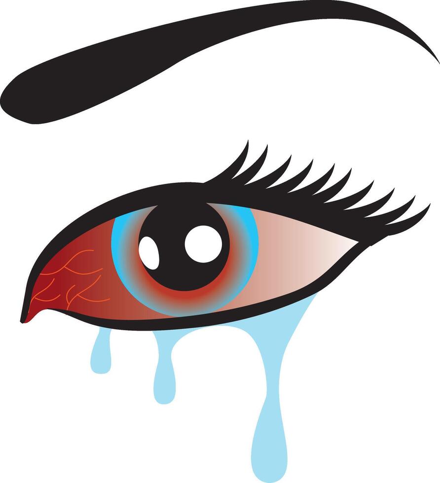 Eye flu infection icon, red eyes disease, Redness of the Eye, Conjunctivitis. vector