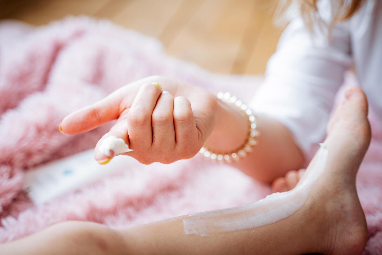 Cream on the finger, smear the leg with dermatitis cream, skin eczema, allergic reaction to medications. photo