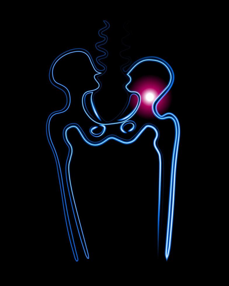 Vector isolated illustration of pelvic bone injury. Pelvic fracture. Pain in the pelvic bone.