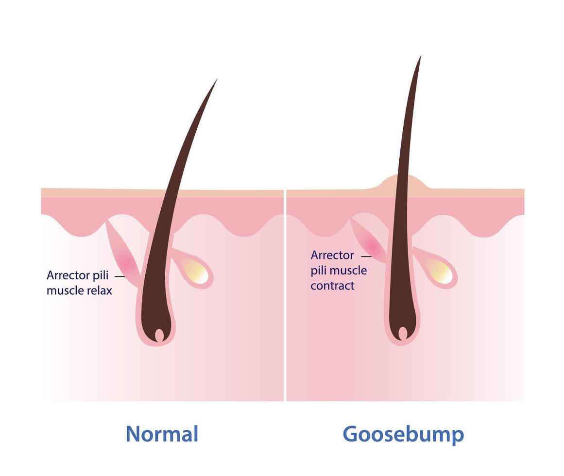 Goosebumps on the skin vector illustration isolated on white