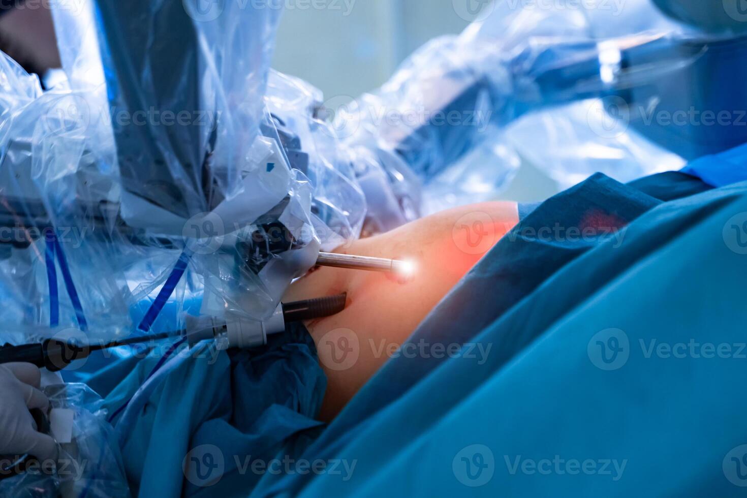 Surgical room in hospital with robotic technology equipment, machine arm surgeon in futuristic operation room. DaVinci robot. Minimal invasive surgical innovation, medical robot surgery with endoscopy photo
