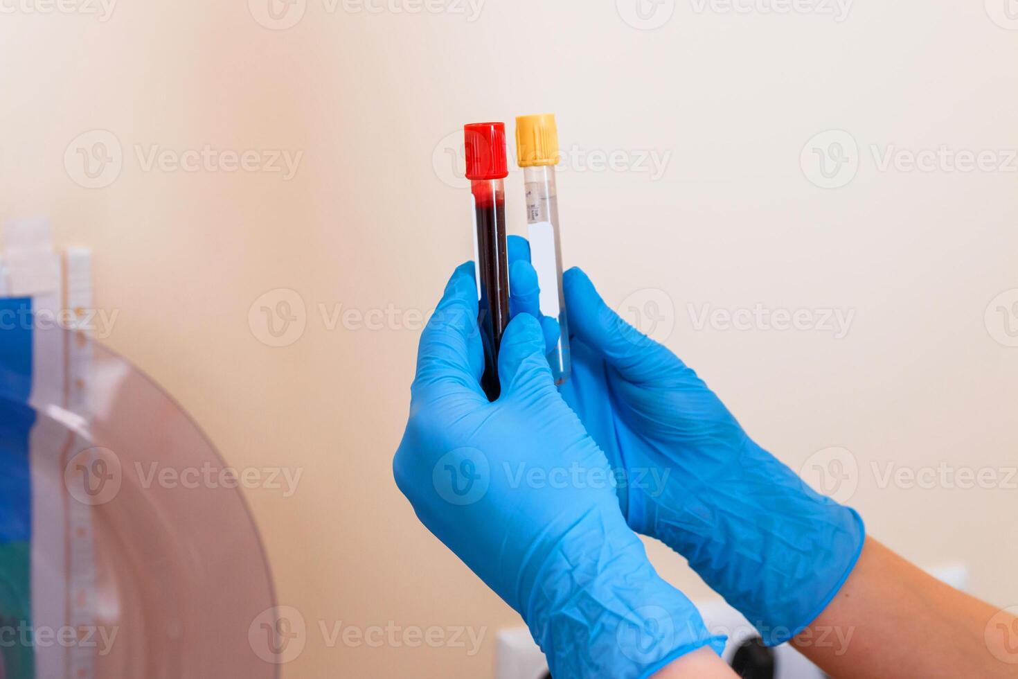 Rack of blood tubes test for analysis in the laboratory of hematology. Pneumonia diagnosing. COVID-19 and coronavirus identification. Pandemic. Assistance in scrabs with medicine tubes. photo