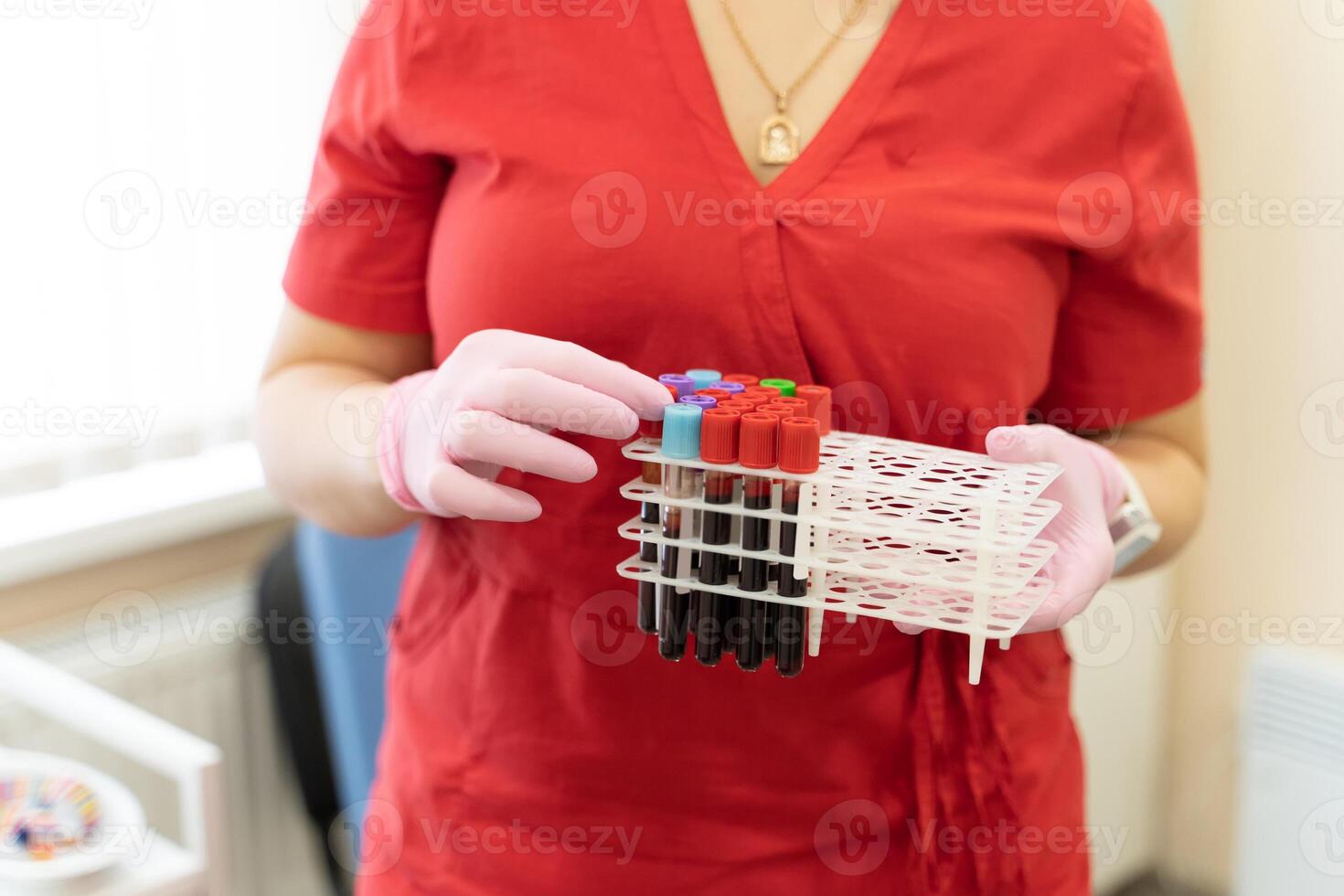 Nurse arranges test tubes with blood on a tray. Virus infection. Pneumonia testing. COVID-19 and coronavirus identification. Pandemic. photo