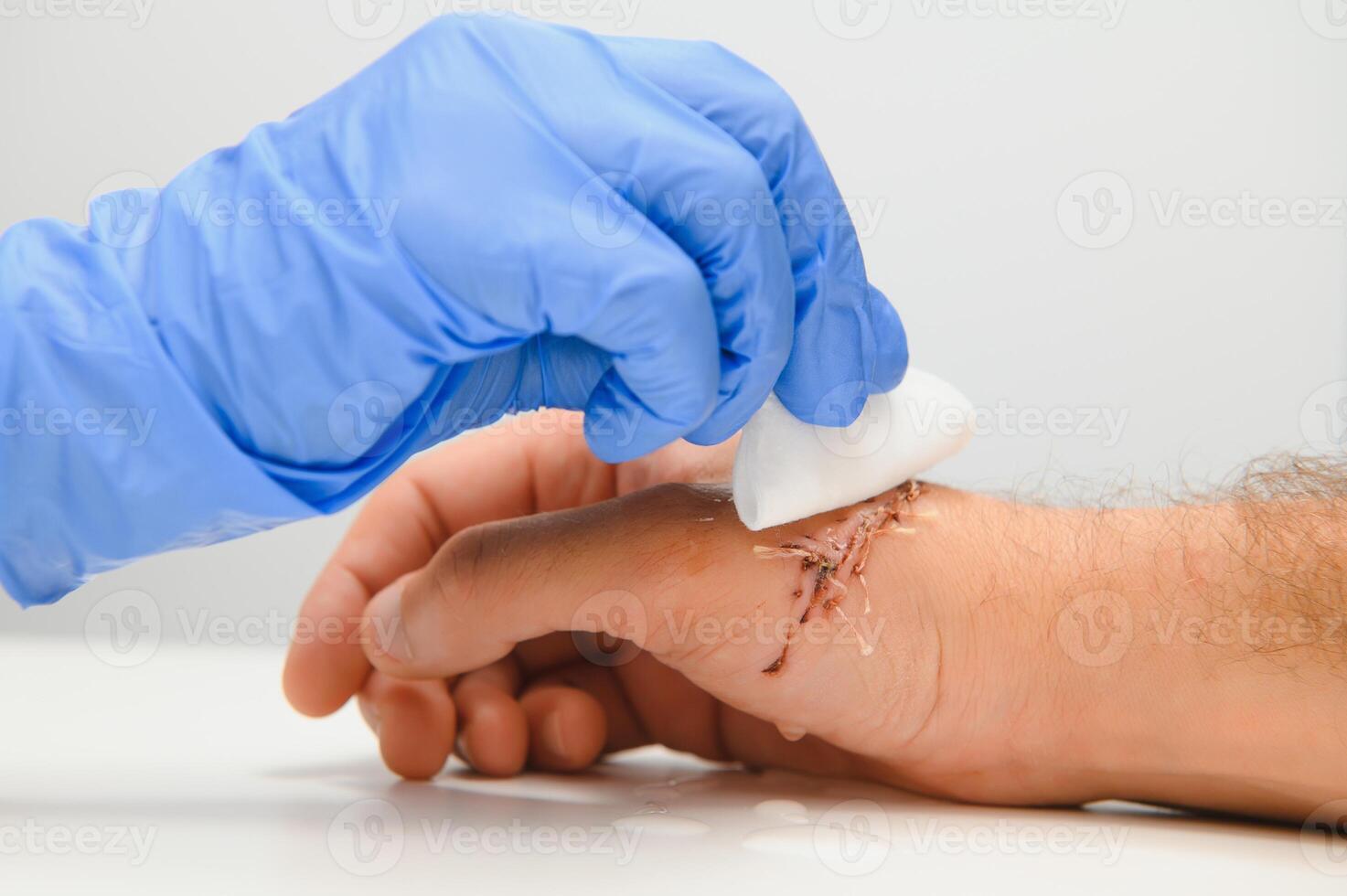enfermero limpieza herida con algodón pelota y vendaje colocar, herida cuidado proceso foto