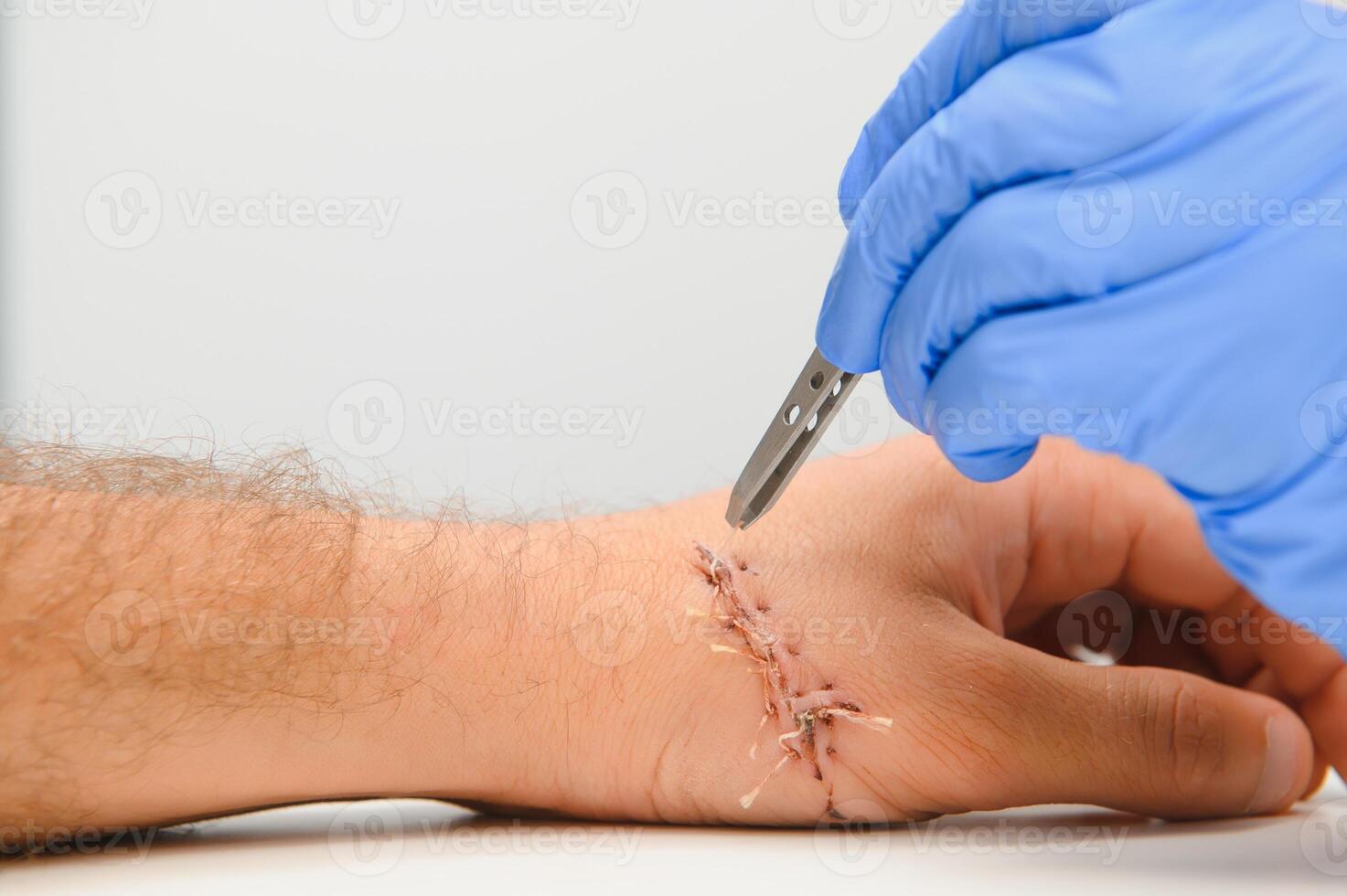 examination by a doctor of a cut on the arm photo