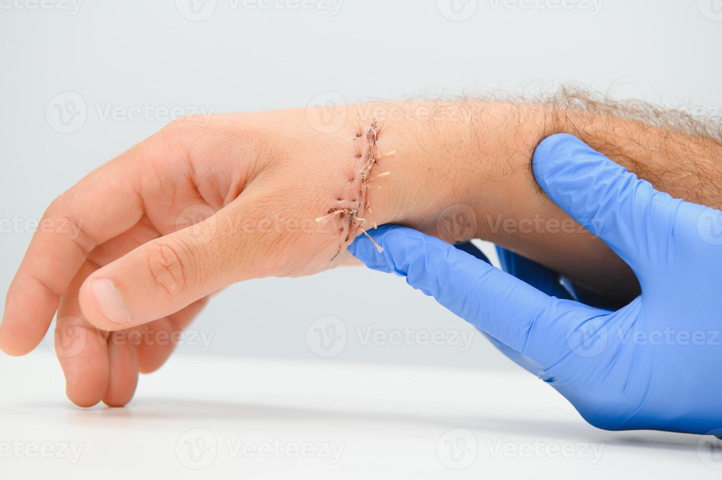 examination by a doctor of a cut on the arm photo