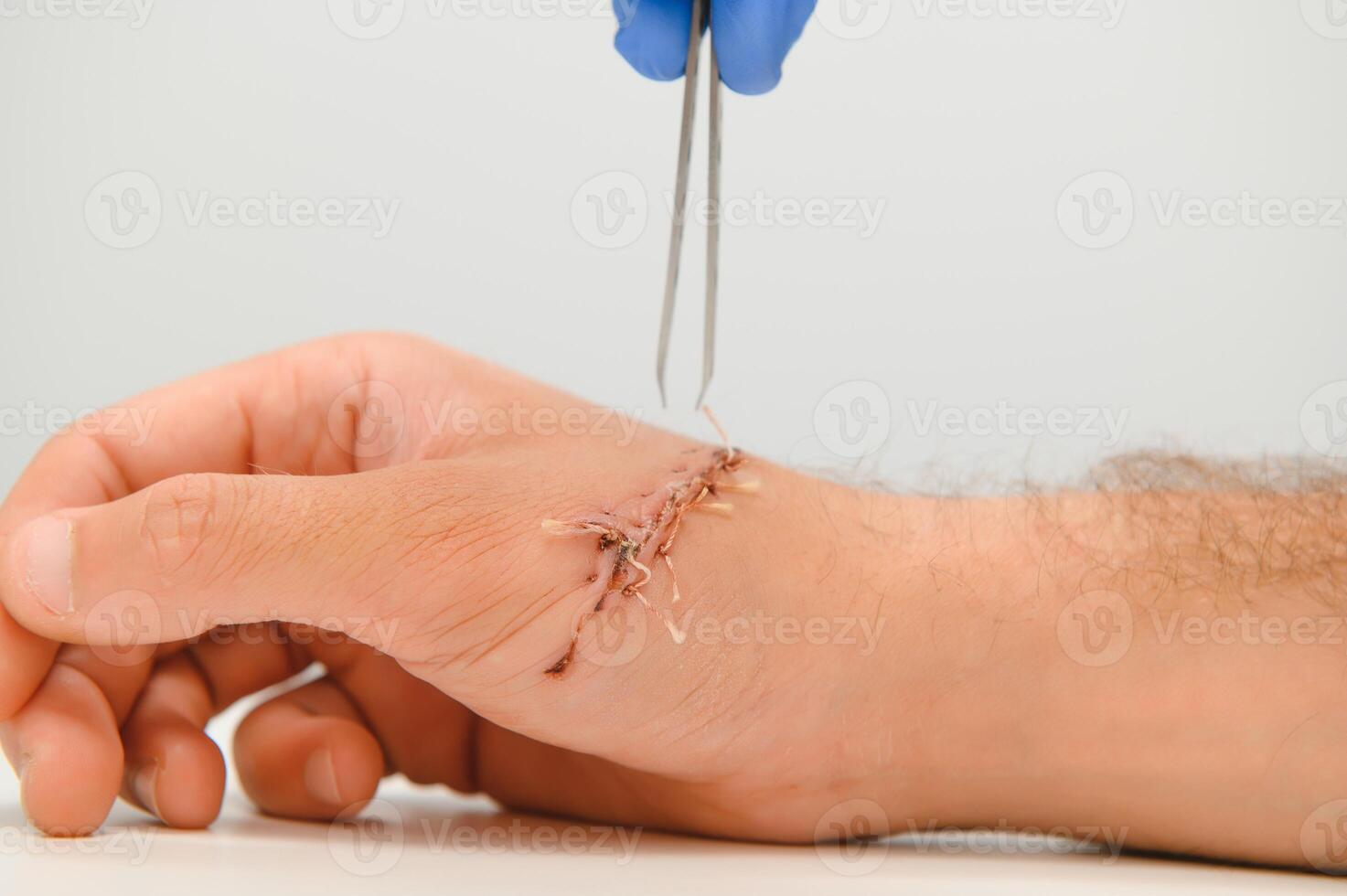 examination by a doctor of a cut on the arm photo