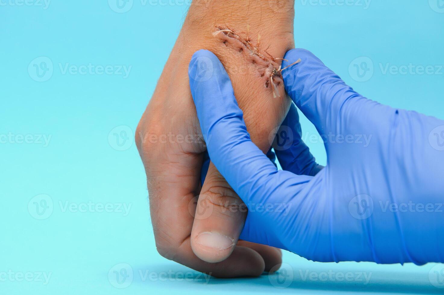 examen por un médico de un cortar en el brazo foto