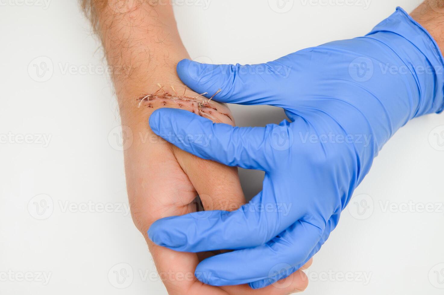 examination by a doctor of a cut on the arm photo