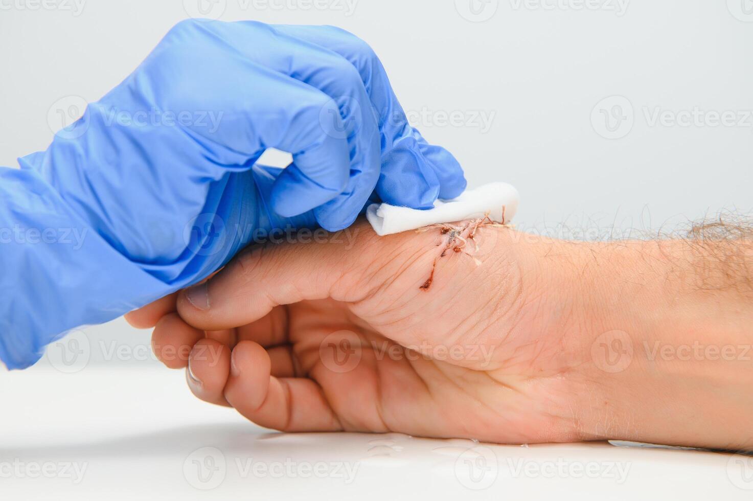 nurse cleaning wound with cotton ball and dressing set, wound care process photo