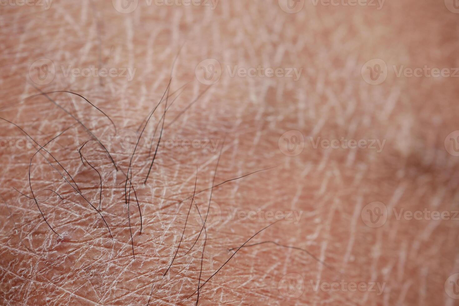 Closeup view of dry human skin . photo