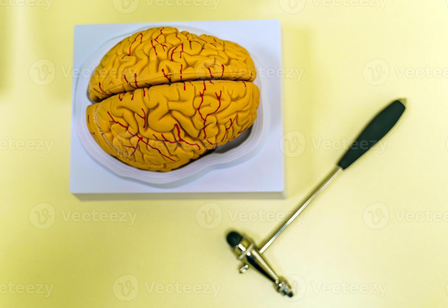 Human brain model for education in laboratory. Neurosurgery concept. photo