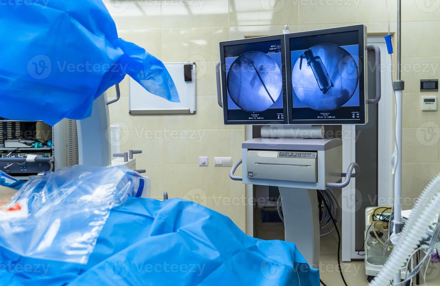 Process of surgery operation using laparoscopic equipment. Operating room with surgery equipment. Medical background. Monitoring the process on screen. photo