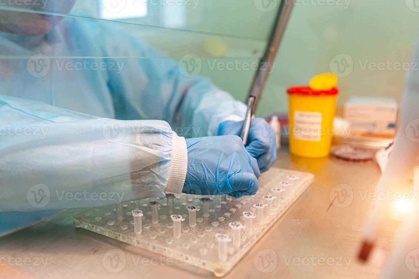 grave clínico estudiando químico elemento en laboratorio. laboratorio de hematología. neumonía diagnosticando. covid-19 y coronavirus identificación. pandemia. medicina cuentagotas. foto