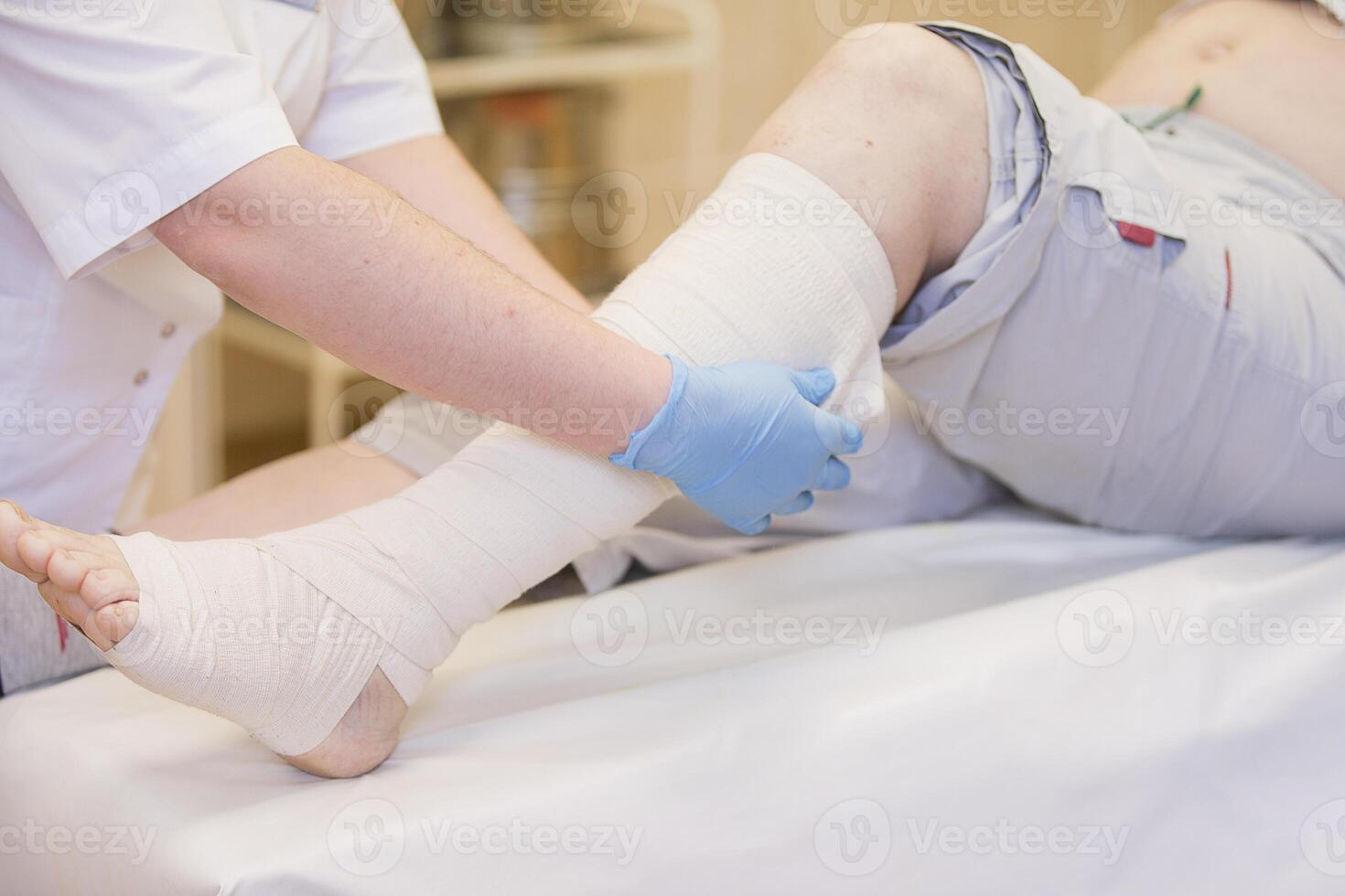 Nurse bandages the leg. Fracture of human lower limbs. Treatment of broken bones. Impose a gypsum. Patient surgical department. The doctor's hands tighten the bandage on his leg photo