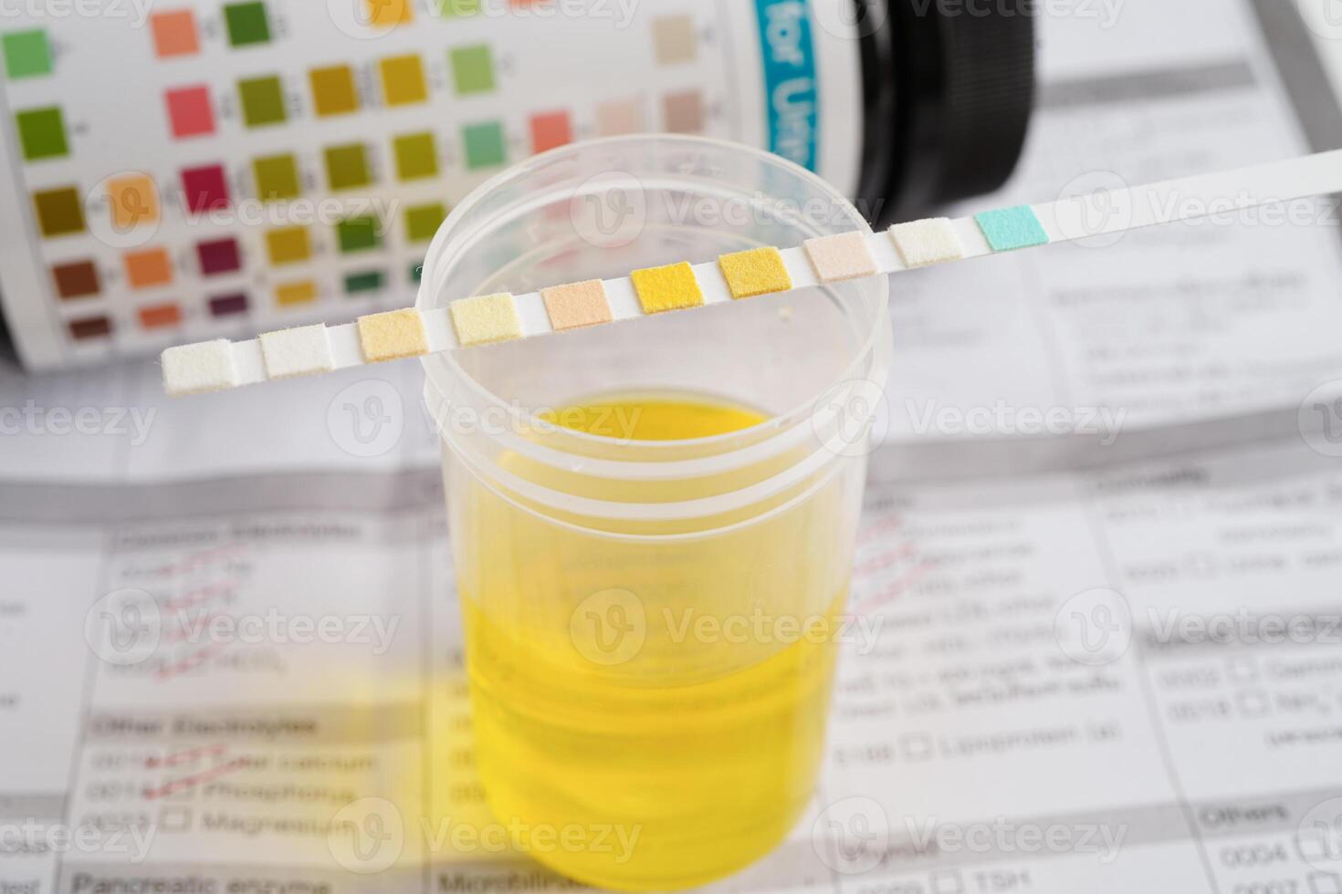 Urinalysis, urine cup with reagent strip pH paper test and comparison chart in laboratory. photo