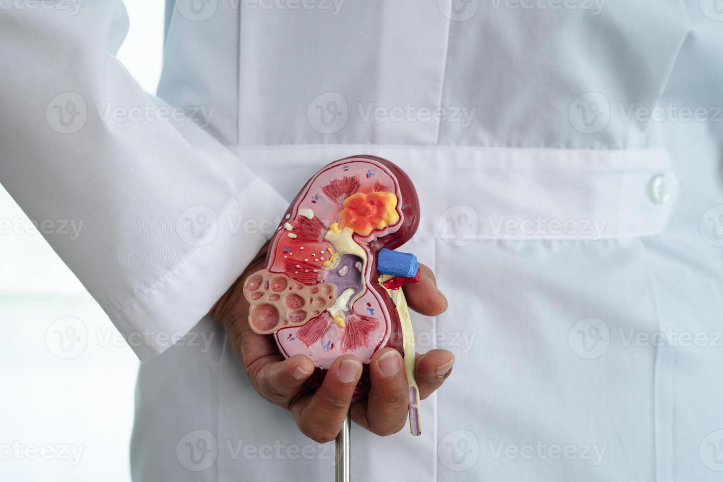 crónico riñón enfermedad, médico con modelo para tratamiento urinario sistema, urología, estimado glomerular filtración Velocidad egfr. foto