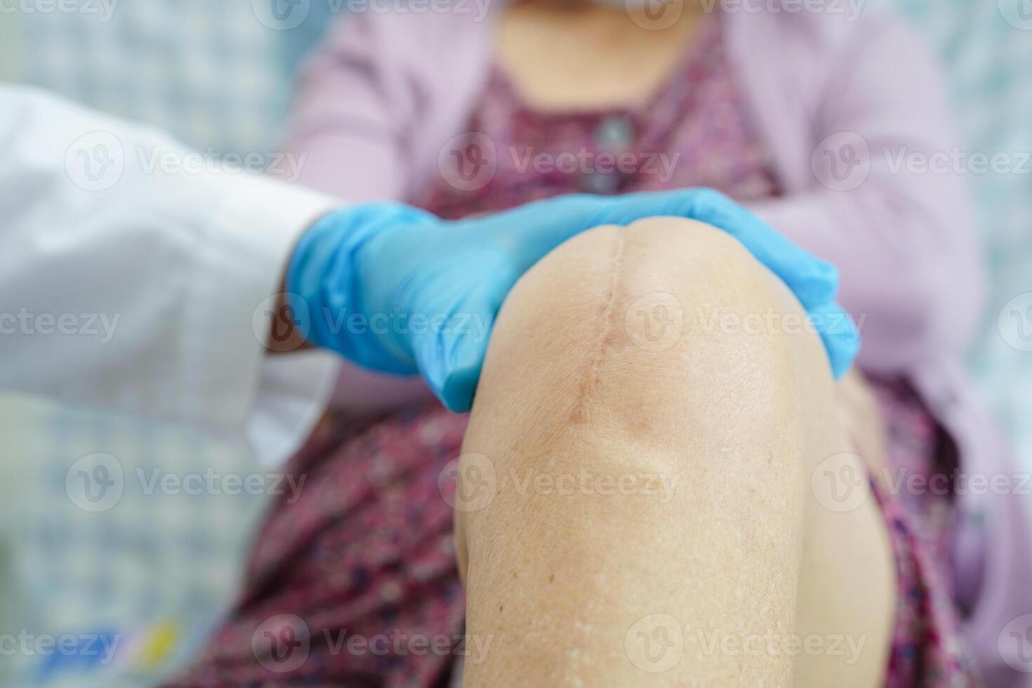 Doctor checking Asian elderly woman patient with scar knee replacement surgery in hospital. photo