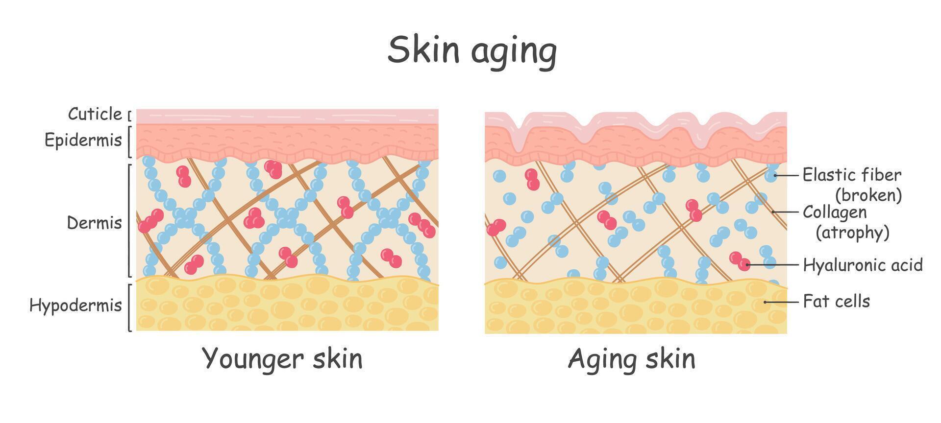 vector diagrama con esquemas de dos tipos de piel, para cuidado de la salud ilustraciones
