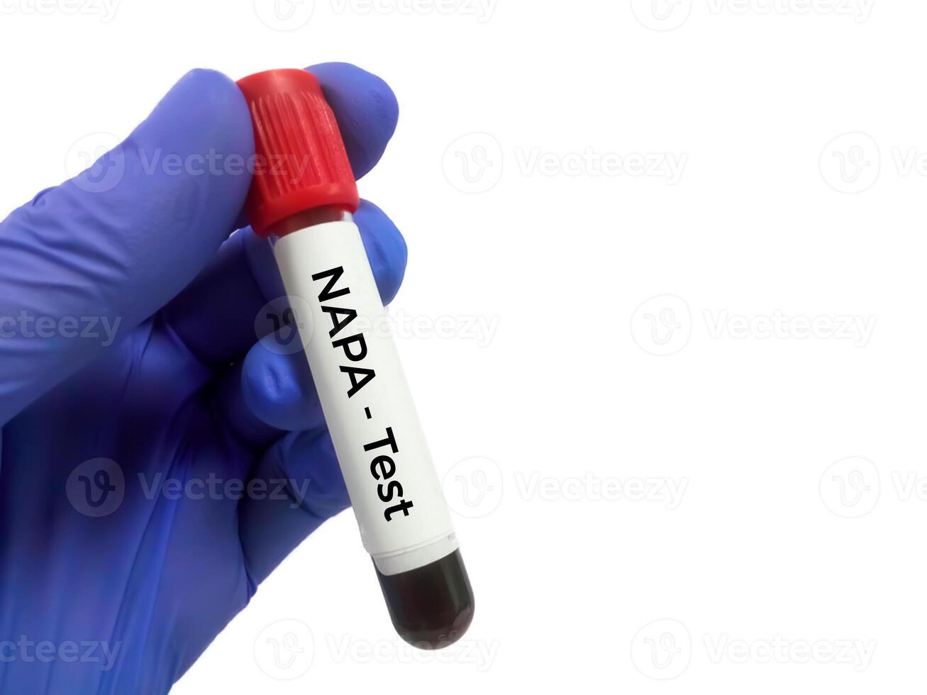 Blood sample for N-acetylprocainamide or NAPA photo