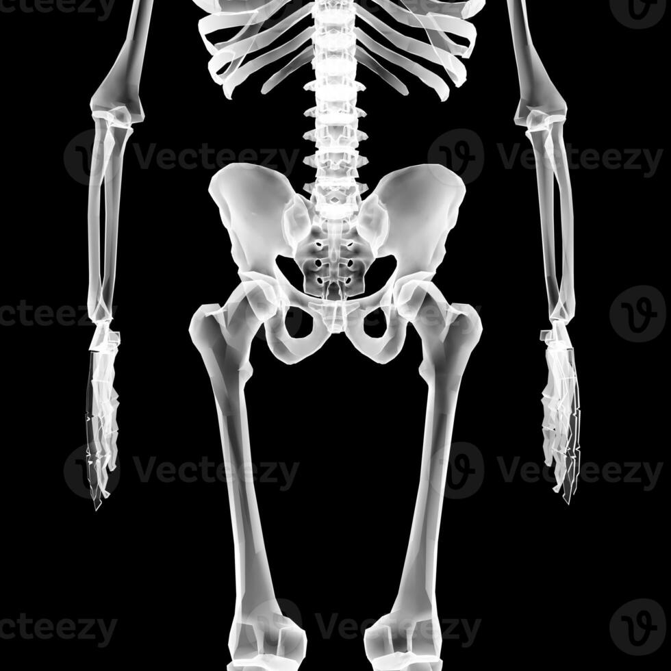 X-ray Vision,of the Human Body and Bones. photo