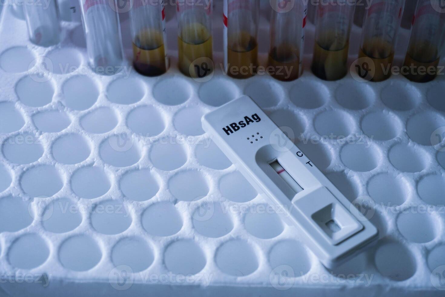 Rapid test cassette for Hepatitis B Virus Test HBsAg on a above the red vacum tube. shows a negative result.Copy space photo