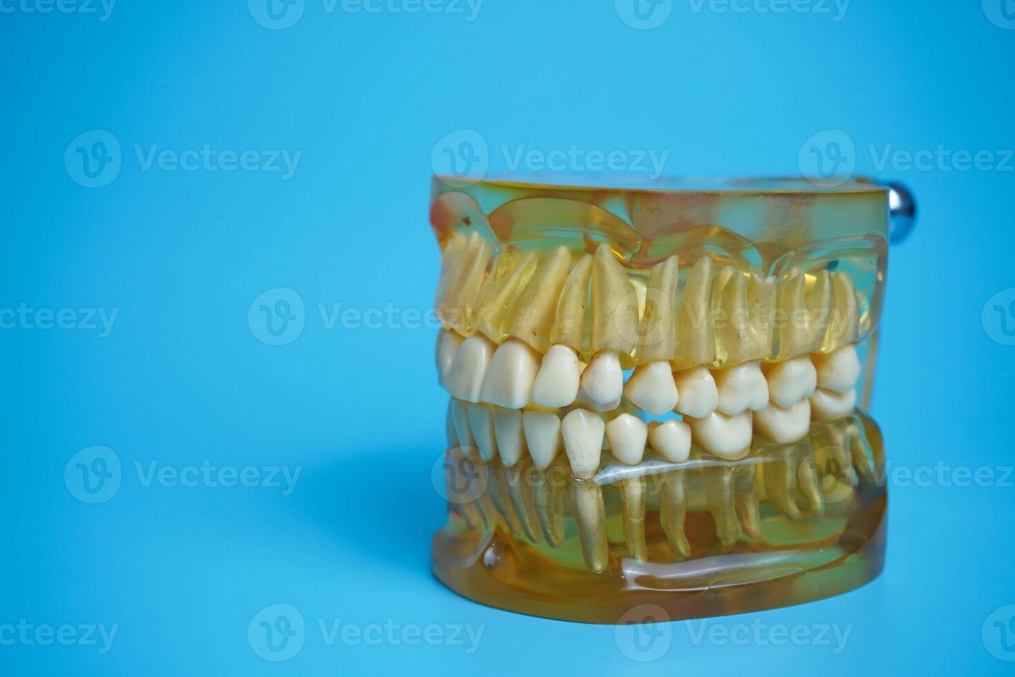 Dentures on a blue background.Upper and lower jaws with false teeth. Dentures or false teeth, close-up. photo