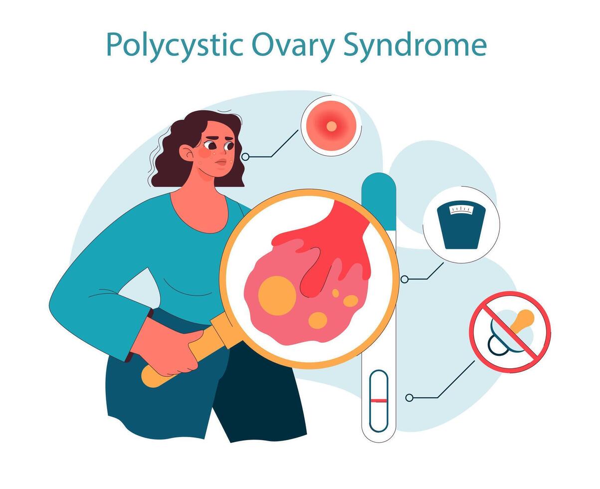 Polycystic ovary syndrome. Woman examining gynecology disease, magnifying vector