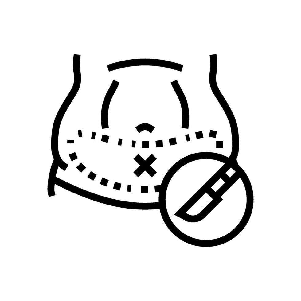 barriguita pliegue abdominoplastia cirugía línea icono vector ilustración