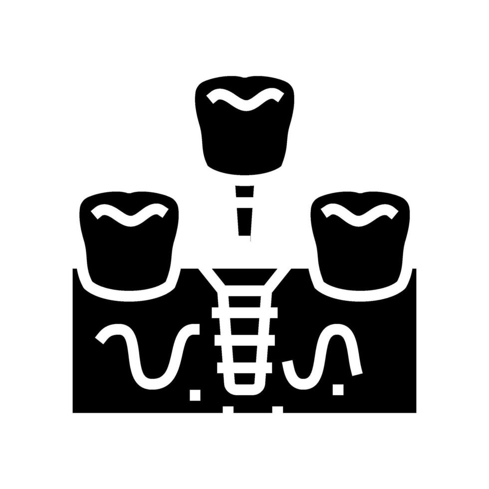 dental implante cirugía cirugía glifo icono vector ilustración