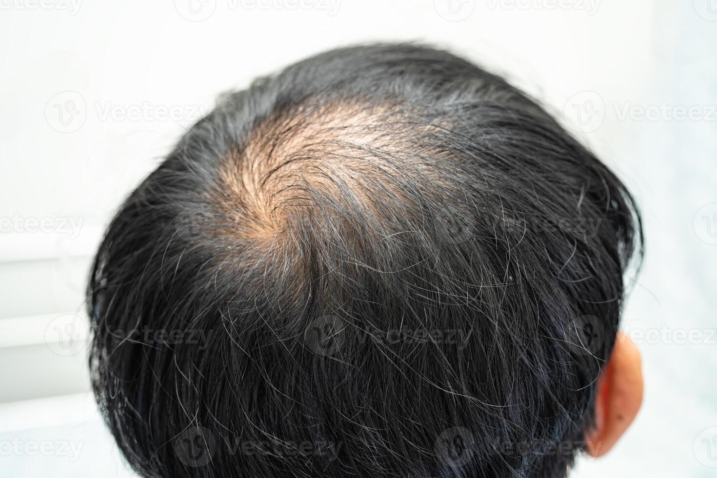 calvo en la cabeza media y sin pérdida de cabello glabro de hombre de oficina activo inteligente de negocios asiáticos maduros. foto