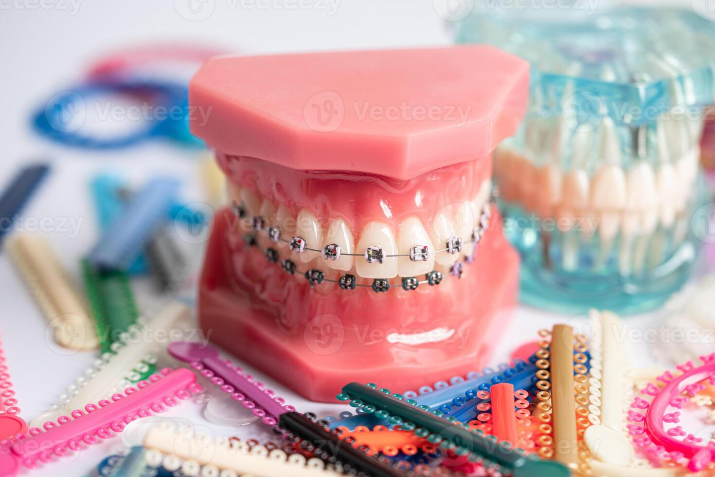 Orthodontic ligatures rings and ties, elastic rubber bands on orthodontic braces, model for dentist studying about dentistry. photo